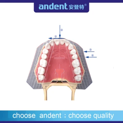 보조 교정 측정 도구 치과 가이드 플레이트